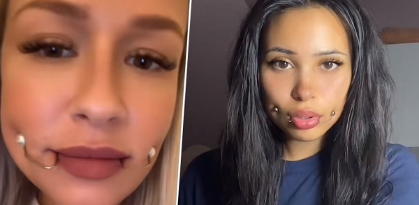 В TikTok учат делать милые ямочки на щеках. Правда, можно остаться с парализованным лицом В TikTok учат делать милые ямочки на щеках. Правда, можно остаться с парализованным лицом