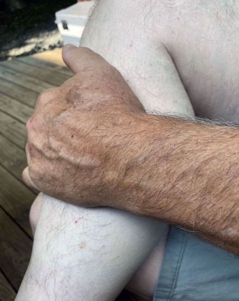 Эти фотографии показали, почему использовать солнцезащитный крем — хорошая идея!