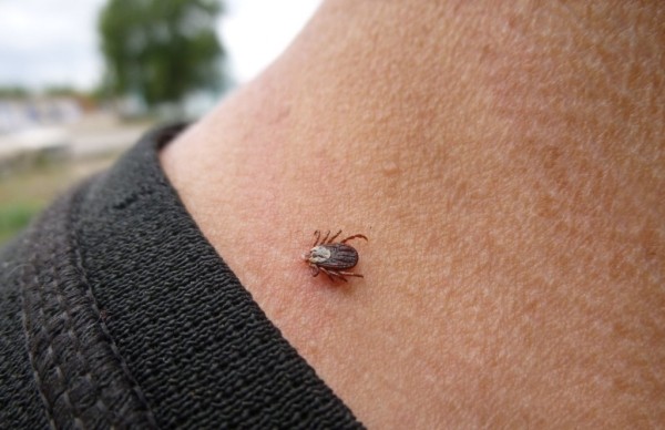 В Брестской области в январе-июне в 1,3 раза увеличилось число пострадавших от укусов клещей В Брестской области в январе-июне в 1,3 раза увеличилось число пострадавших от укусов клещей