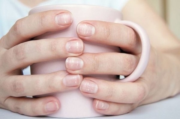 Гастроэнтеролог рассказала о причинах появления белых пятен на ногтях Гастроэнтеролог рассказала о причинах появления белых пятен на ногтях